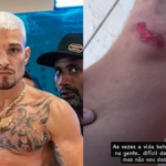 MC Gui relata novo acidente após incêndio na casa da família